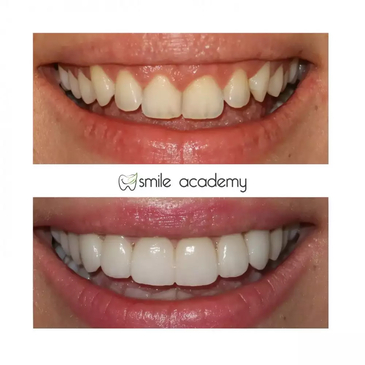 Slider image (4) Esthetic Smile Academy 